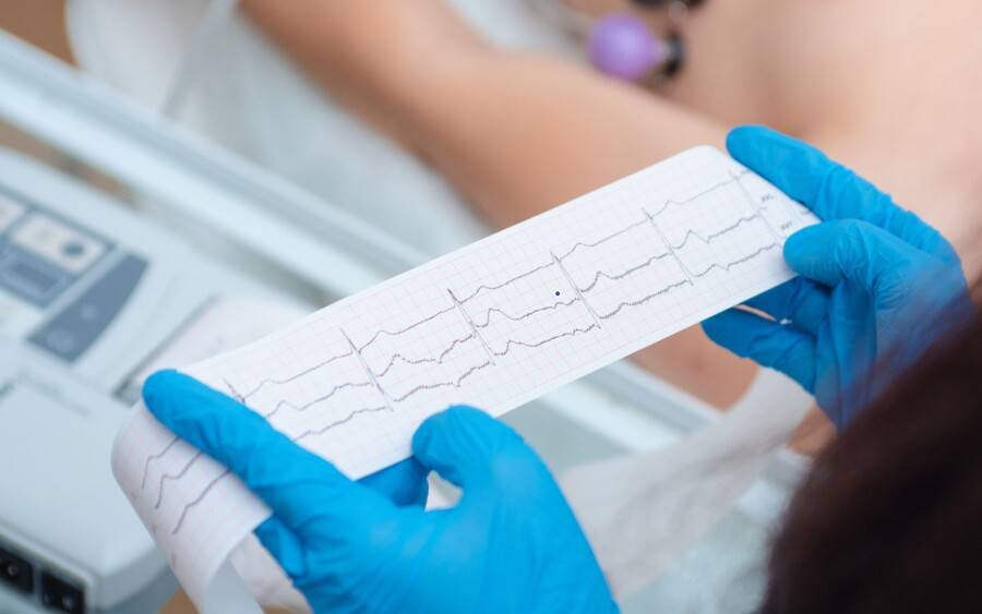 EKG shows heart rate activity.