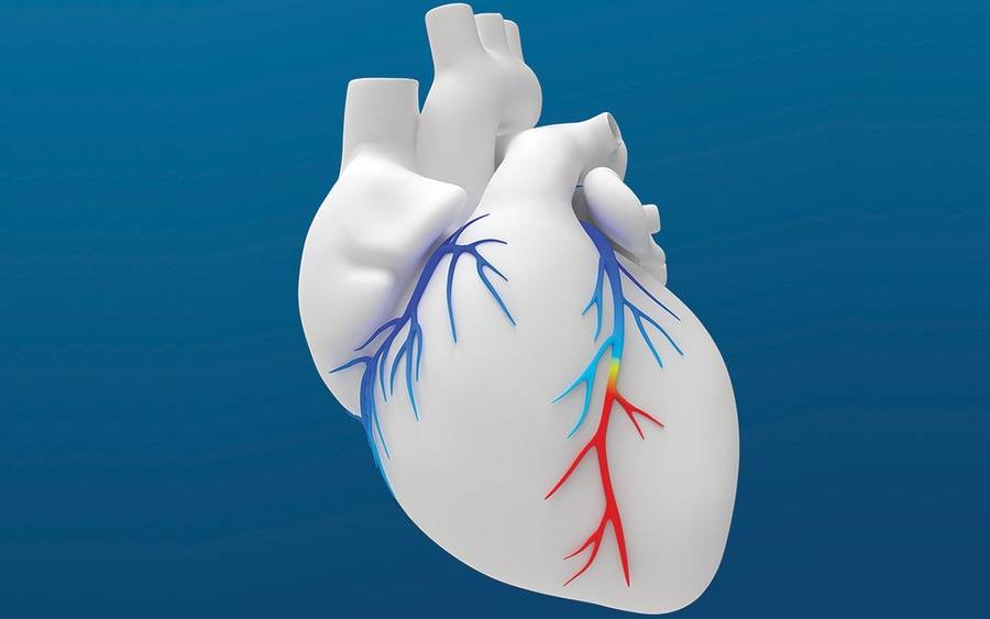The HeartFlow FFRct Analysis is a non-invasive tool used by Scripps La Jolla cardiologists to identify blockages.