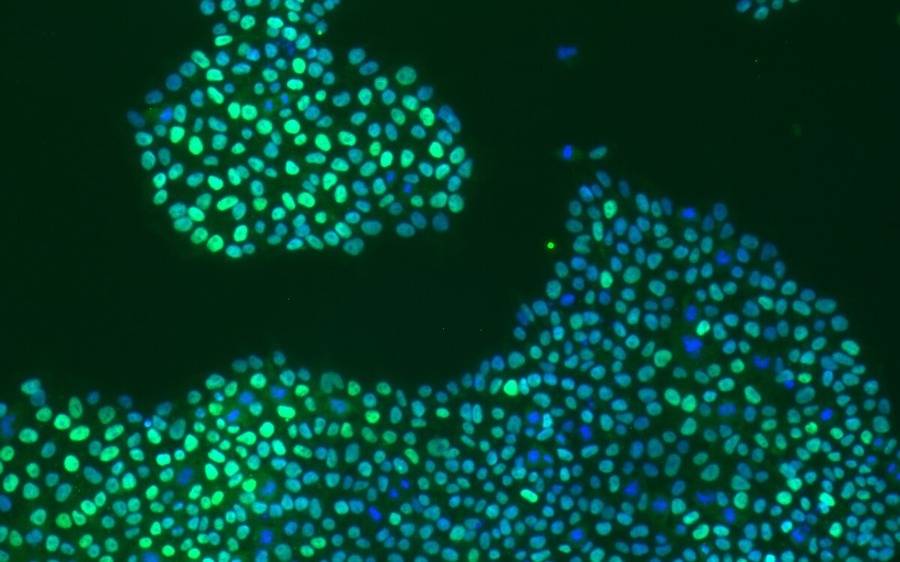 An image of an important type of stem cell where DNA mutations increase in aging process.