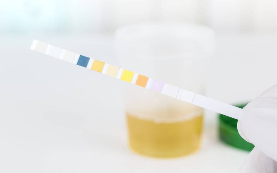 A urine test can be used to reveal illnesses. Pay attention to your urine color.