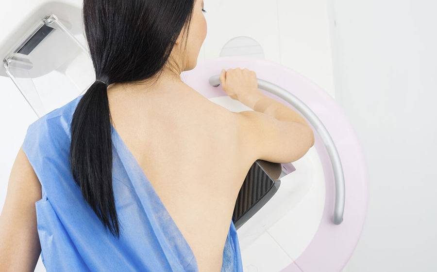 A woman stands in front of a mammography machine.