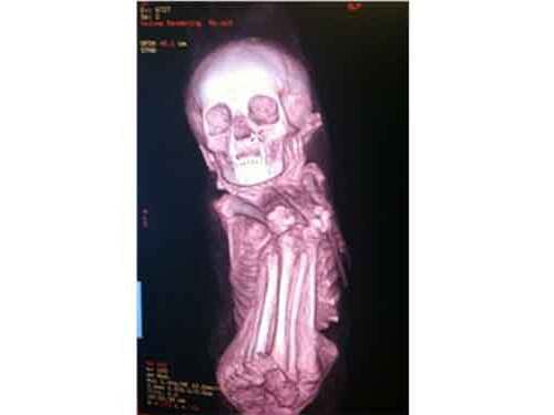 Scripps scans mummy