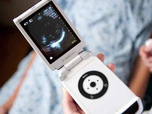 In another installment, "Paying Till It Hurts," Scripps Health cardiologist, Dr. Eric Topol, was interviewed by NY Times writer Elisabeth Rosenthal.  Covering the topic of hand held heart ultrasound device that may reduce healthcare costs.