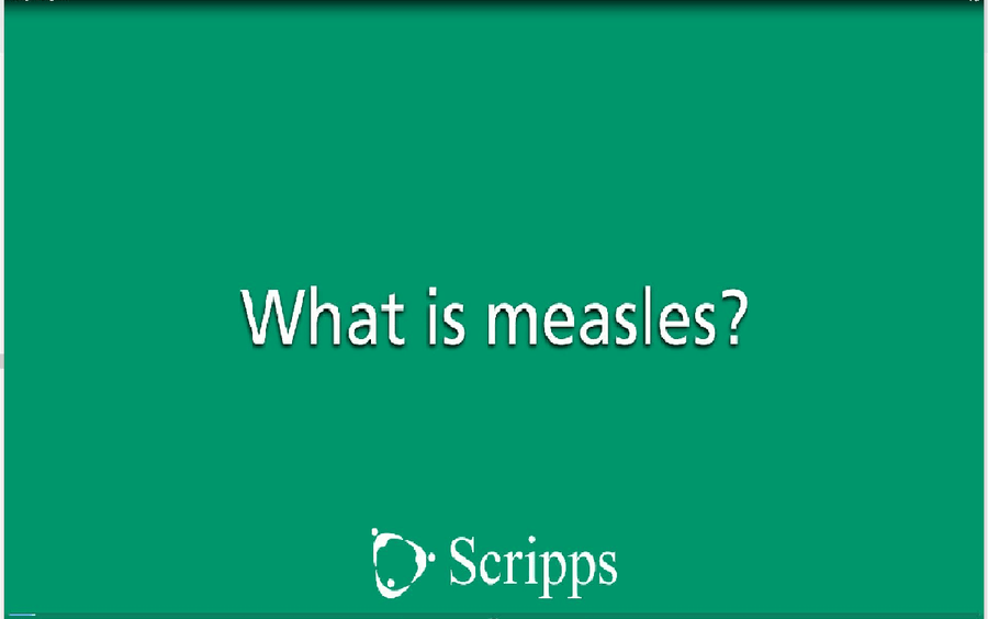Measles immunization is important.