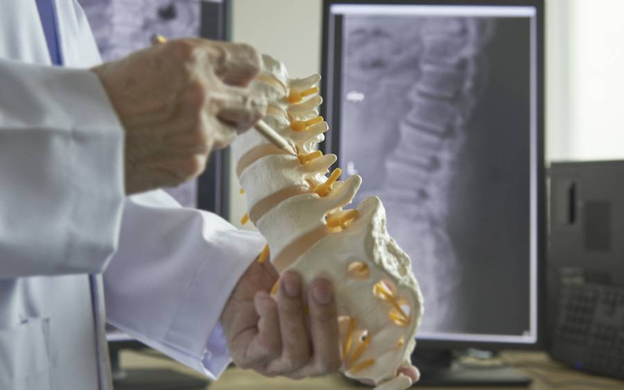An orthopedic doctor pinpoints a spot in a model of the spine column.