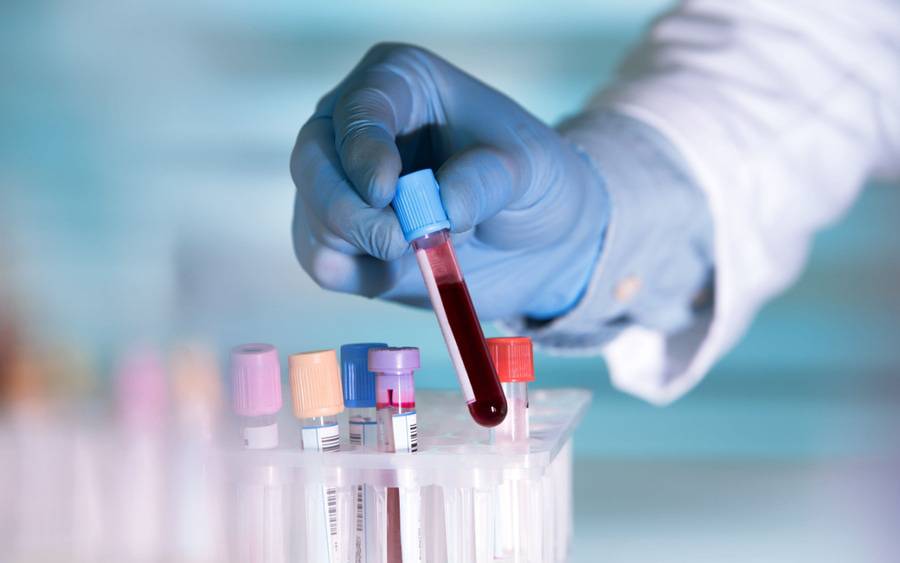 A blood test to check for cholesterol levels.