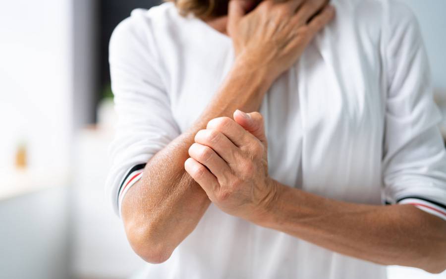 A woman scratches her arm. Could be related to cancer or cancer-related treatment.