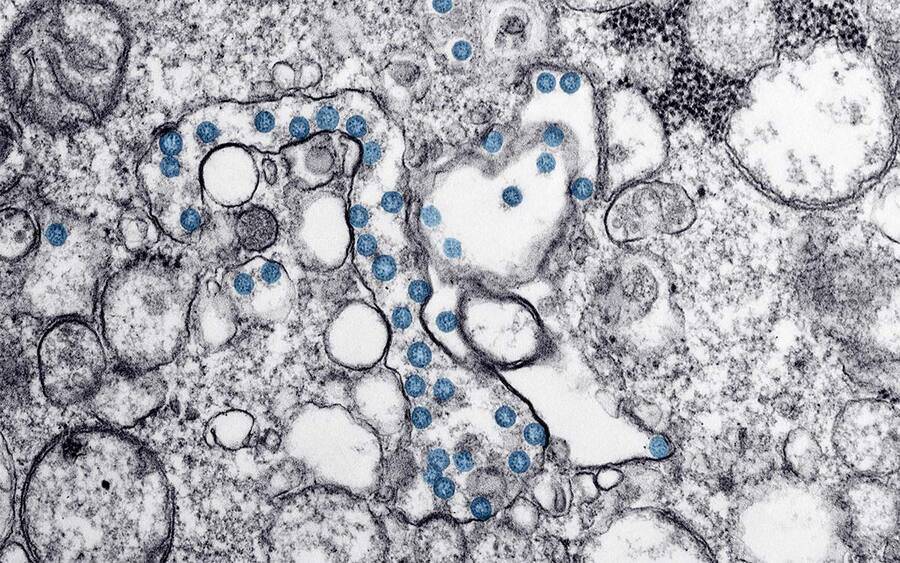 A microscopic image of the new coronavirus (COVID-19).