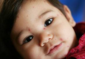 E-news_Oct 2012_vaccinations