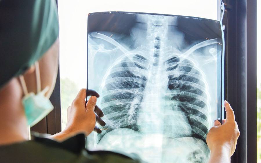 A provider holding up a chest x-ray.