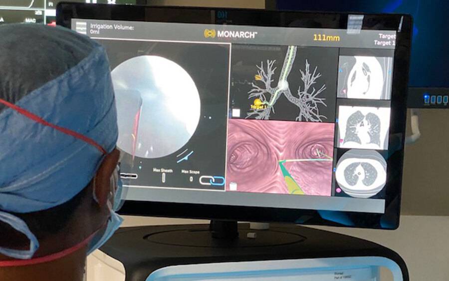 Dr. Samir Makani looks at a computer monitor while performing robotic bronchoscopy at Scripps Memorial Hospital Encinitas.