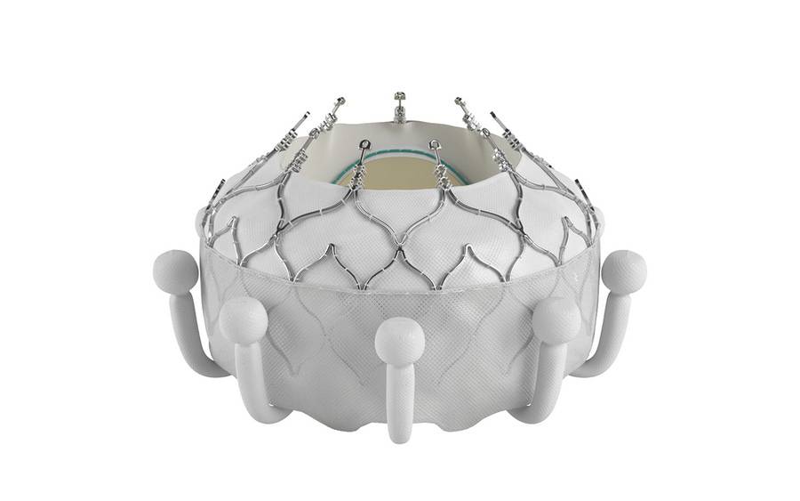 Image of the EVOQUE replacement valve used in first minimally invasive tricuspid valve replacement in
San Diego by Scripps.