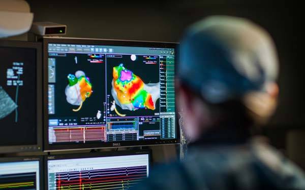 Scripps Health in San Diego is at the forefront of care for atrial fibrillation.