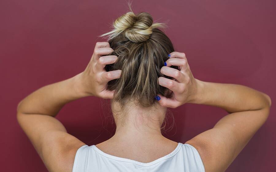 Woman with itchy scalp.