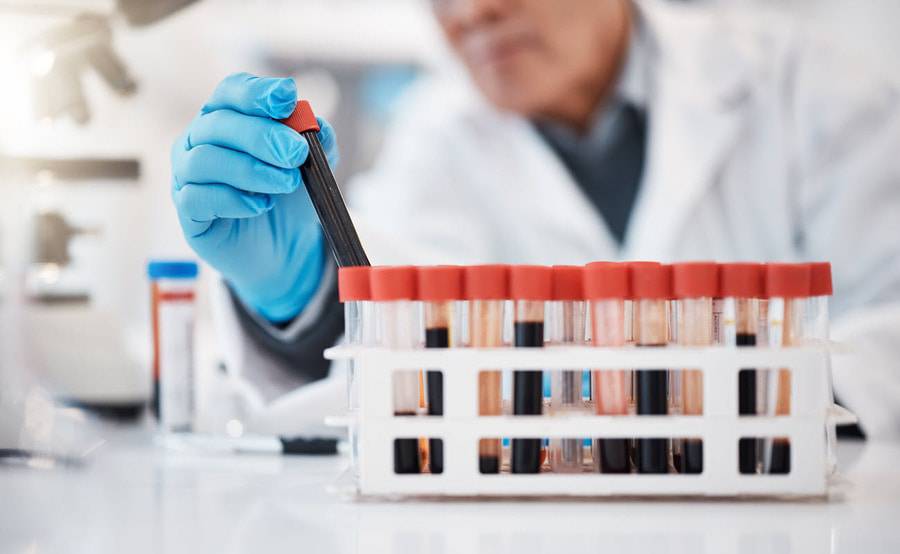 A laboratory specialist tests blood samples for patients.