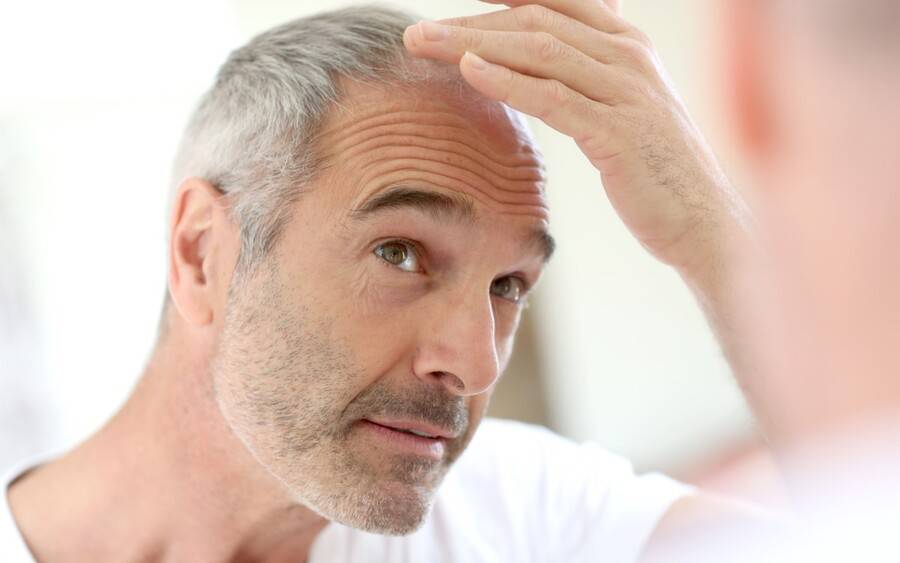 Man with thinning hair looking at mirror.