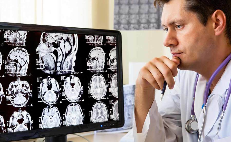 Neurology San Diego Scripps Health