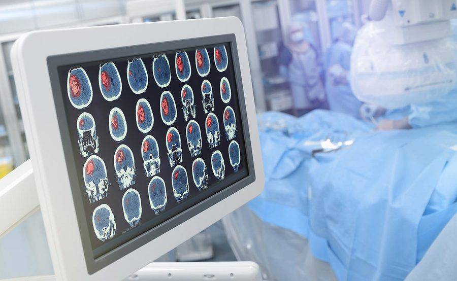 A monitor with images of a patient's brain.