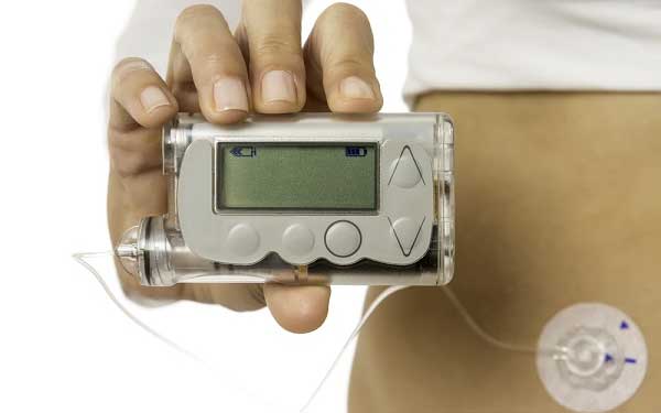 In her recent posting to the Type 2 diabetes blog by Everyday Health, Dr. Athena Philis-Tsimikas addresses the benefits of using a continuous glucose monitoring system.