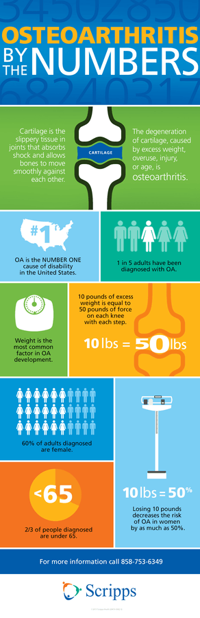 Infographic showing statistics about osteoarthitis of the knee.