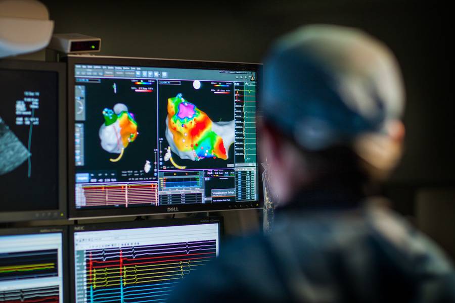 A surgeon looks at 3D images of a heart on a computer monitor, representing the impact of cardiovascular research at Scripps.