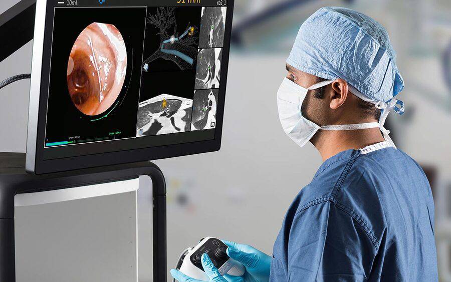 An interventional pulmonologist looks at a monitor and holds a small controller while performing robotic bronchoscopy.