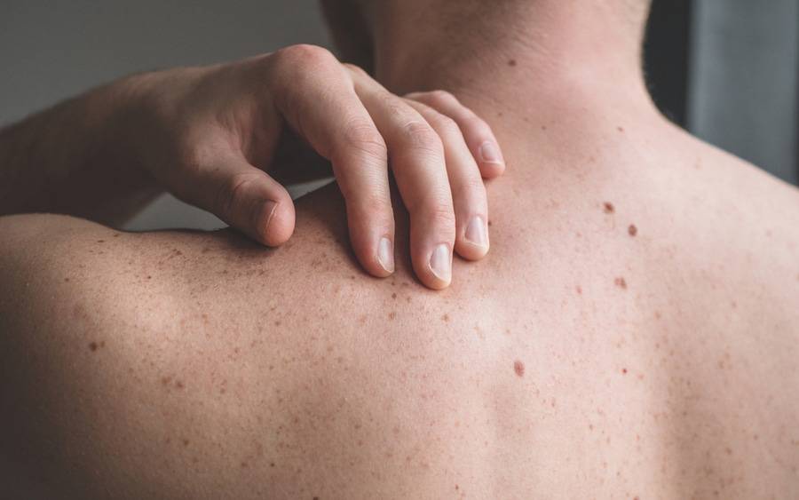 Skin Bumps and Lumps: Do Mean? - Health