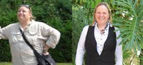 Clinic Bariatrics Before and After Terri