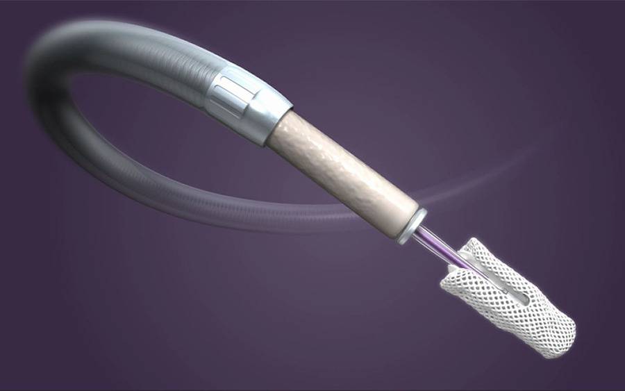 An illustration of the TriClip experimental clip for tricuspid heart valve repair. 