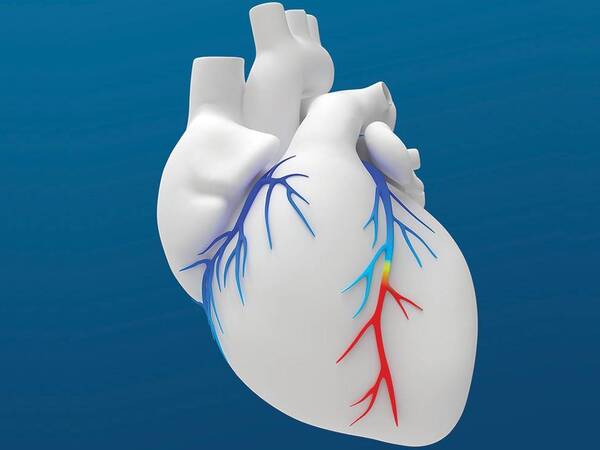 A rendering of a human heart against a blue background