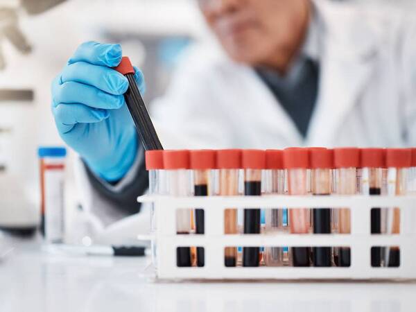 A laboratory specialist tests blood samples for patients.