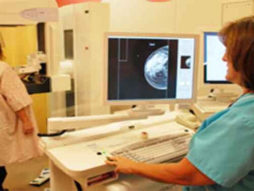 Scripps physicians make local news with their publication on the recent changes in mammogram recommendations.
