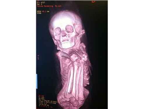 Imaging Scans at Scripps La Jolla Used to Learn More About Mummies