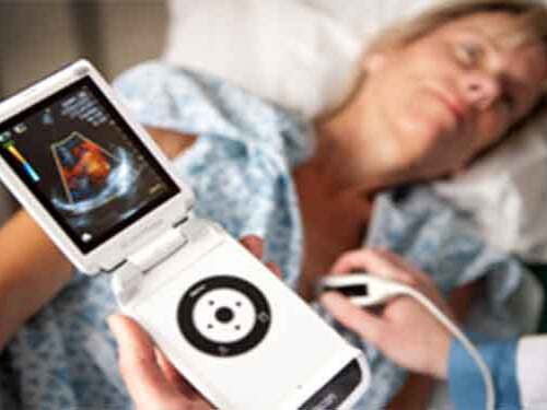 Scripps study validates pocket ultrasound device that enables a physician to “look” at a patient’s heart.