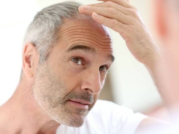 What Are the Types of Hair Loss and Treatments? - Scripps Health