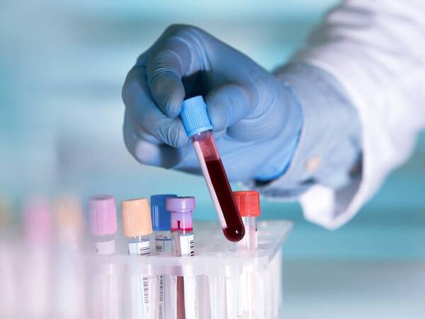 A blood test can check if you have high cholesterol level.