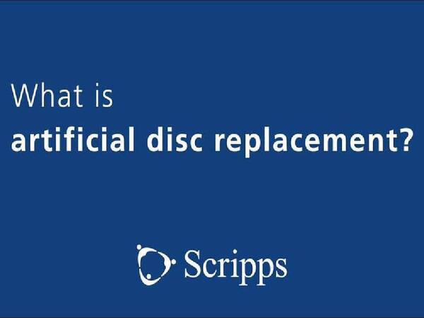 What is artificial disc replacement? Learn who is a candidate for this minimally invasive procedure. 