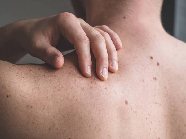 Skin Bumps and Lumps: What Do They Mean? - Scripps Health