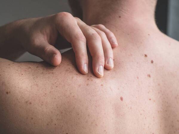Itchy bumps on skin deals