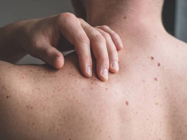 white bumps on chest