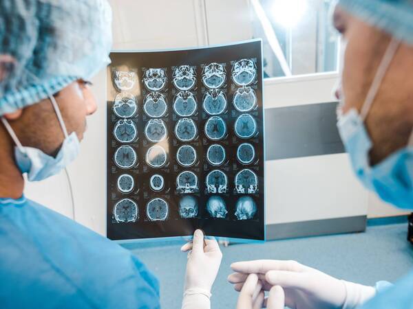 Two doctors examine an X-ray looking for signs of liver cancer.