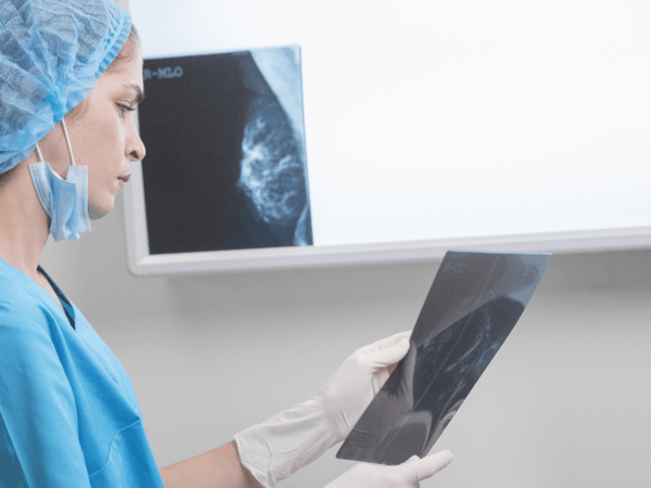 A doctor examines a mammogram checking for breast cancer.