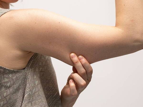 How to Get Rid of Saggy Skin After Weight Loss