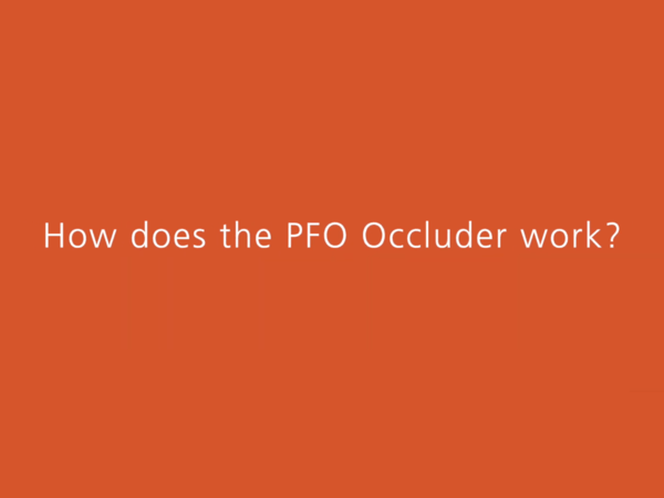How to Prevent Cryptogenic Stroke with the PFO Occluder (video)