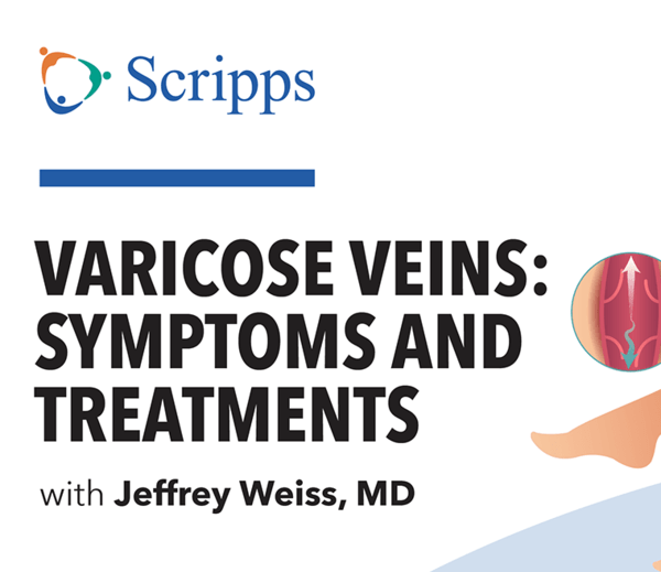 What Is the Best Treatment for Varicose Veins? (video)