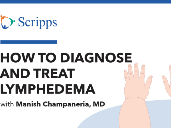 Thumbnail for video/podcast featuring Dr. Champaneria discussing lymphedema.