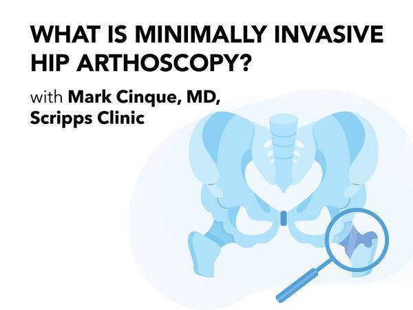 What Is Hip Arthroscopy? (video/podcast)
