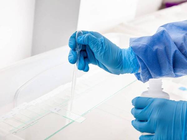 Scripps Dermatologists Advancing Skin Cancer Care