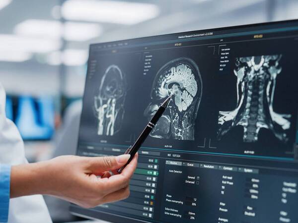 A neurologist reviews brain scans on a monitor, representing the clinical expertise and advanced technology used for treating neurological disorders at Scripps.