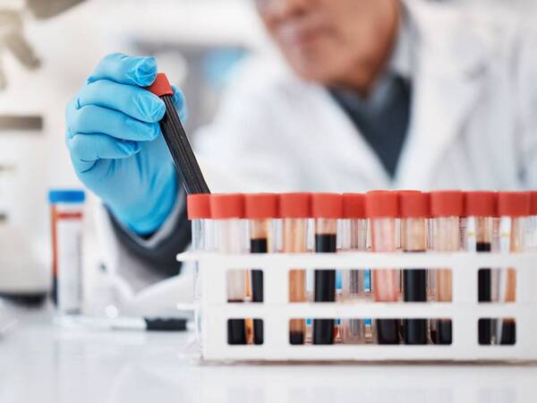 A laboratory specialist tests blood samples for patients.